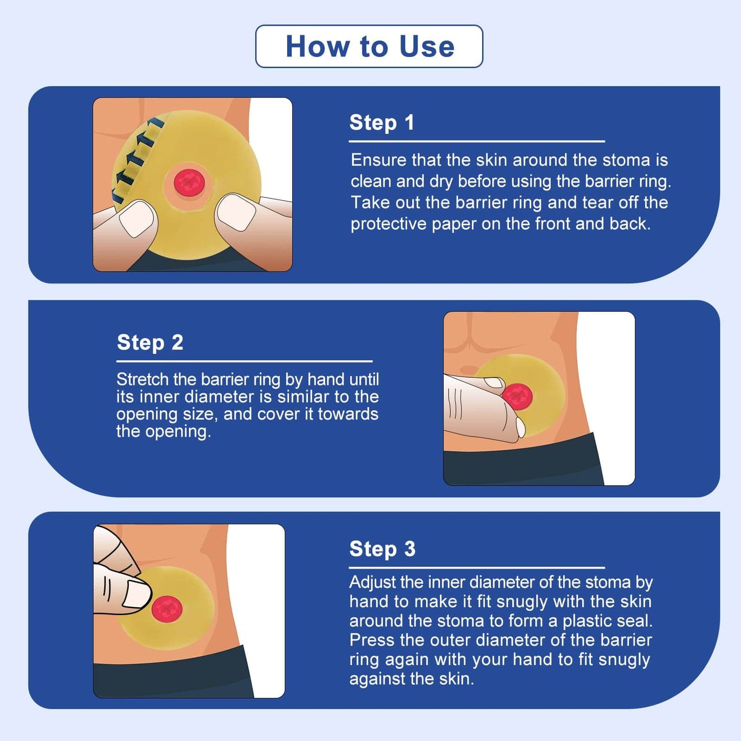 How to use barrier ring