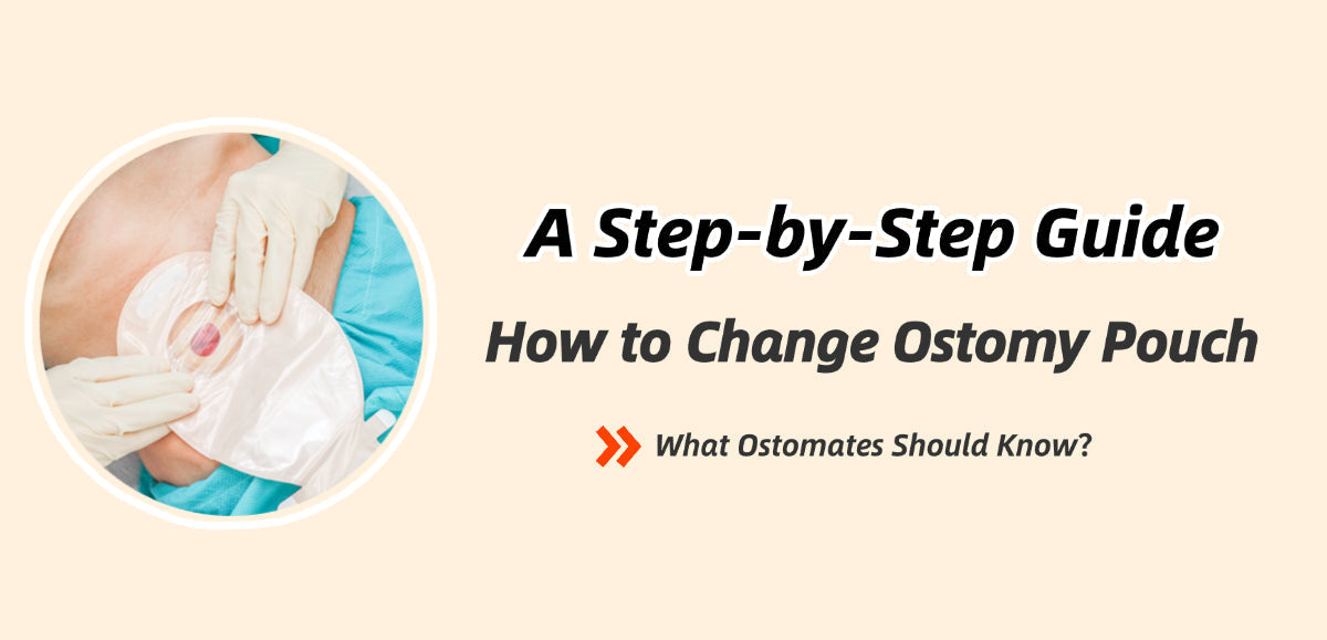 How to Change Ostomy Pouch: A Step-by-Step Guide