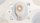 Loop Stoma Care: Pouching, Skin Protection, and Warning Signs