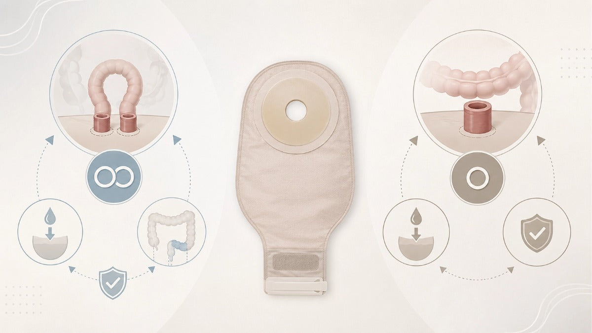 Loop Stoma vs. End Stoma: What Is the Difference?