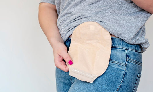 Do Ostomy Bags Smell? What You Need to Know About Odor Control