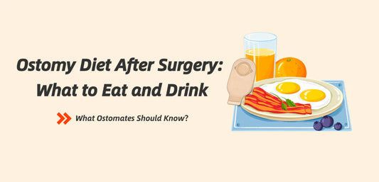 Ostomy Diet After Surgery: What to Eat and Drink
