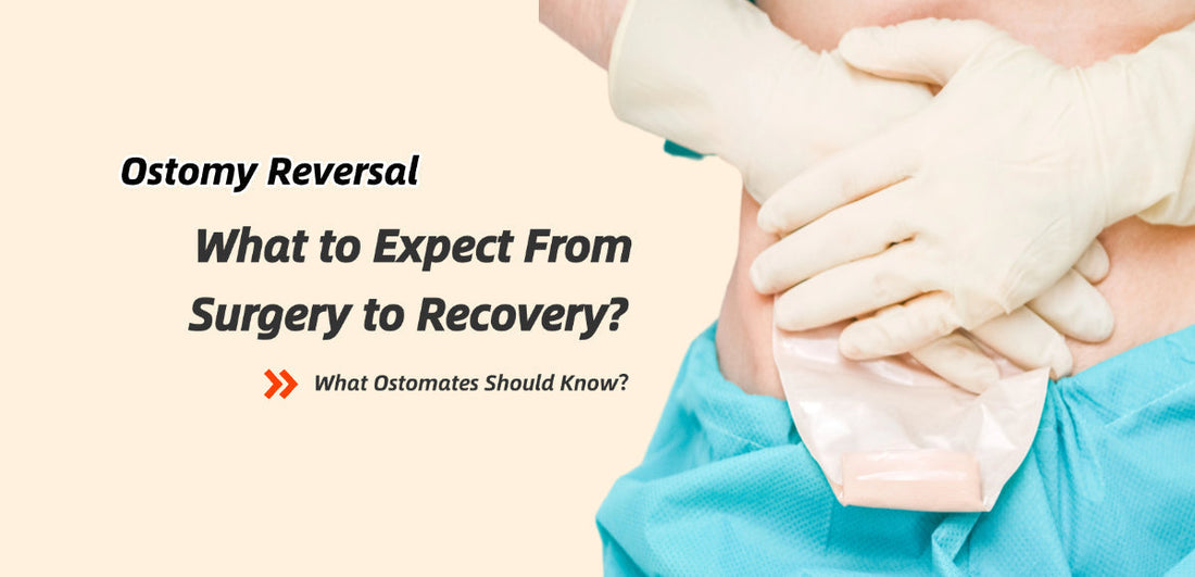 Ostomy Reversal: What to Expect From Surgery to Recovery