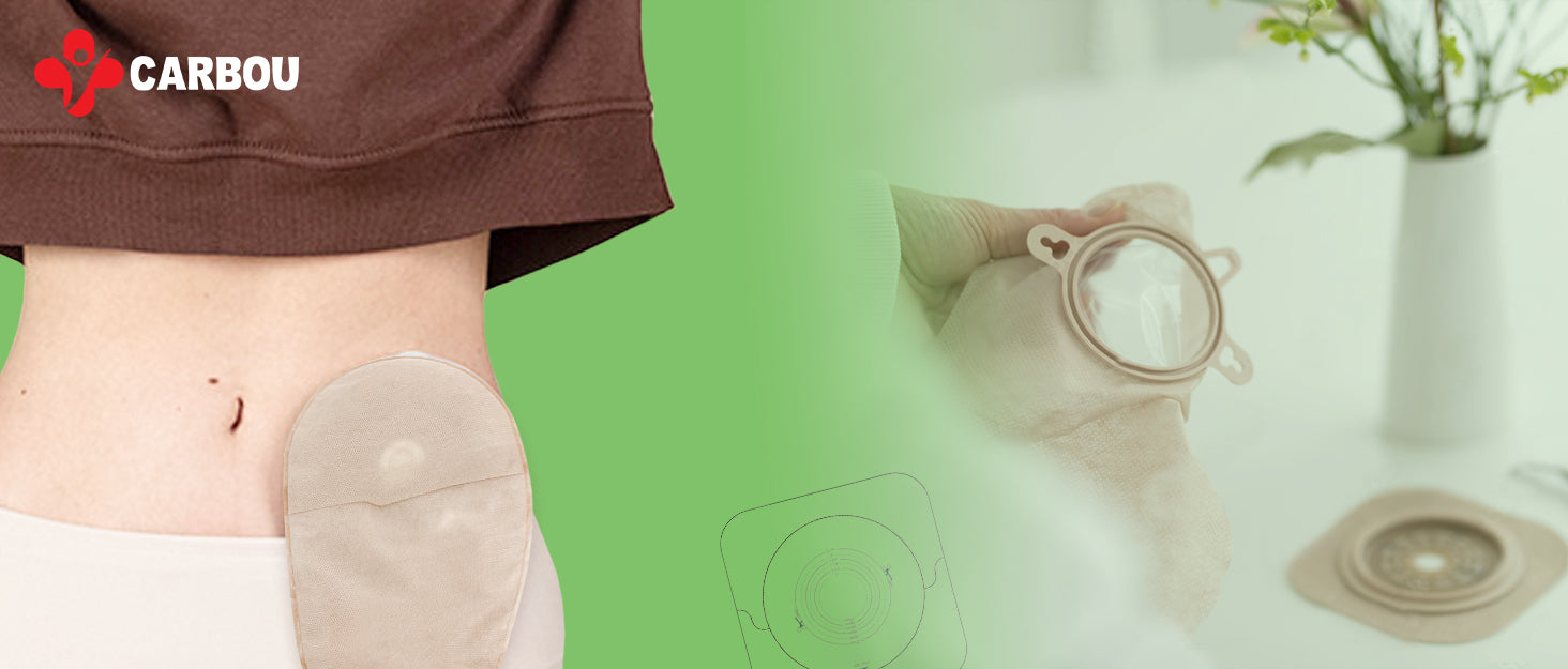 How Long Does an Ostomy Bag Stay On? A Patient & Family Guide