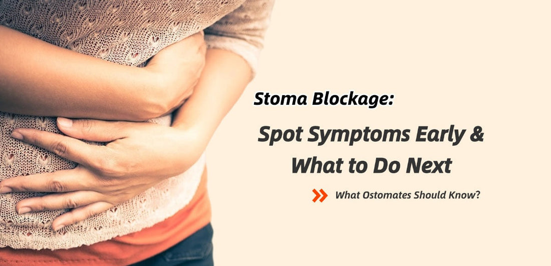 Stoma Blockage: Spot Symptoms Early & What to Do Next