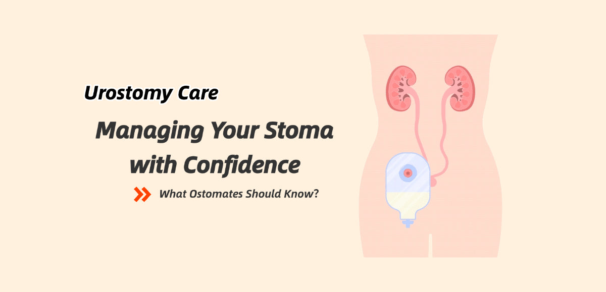 Urostomy Care: Managing Your Stoma with Confidence
