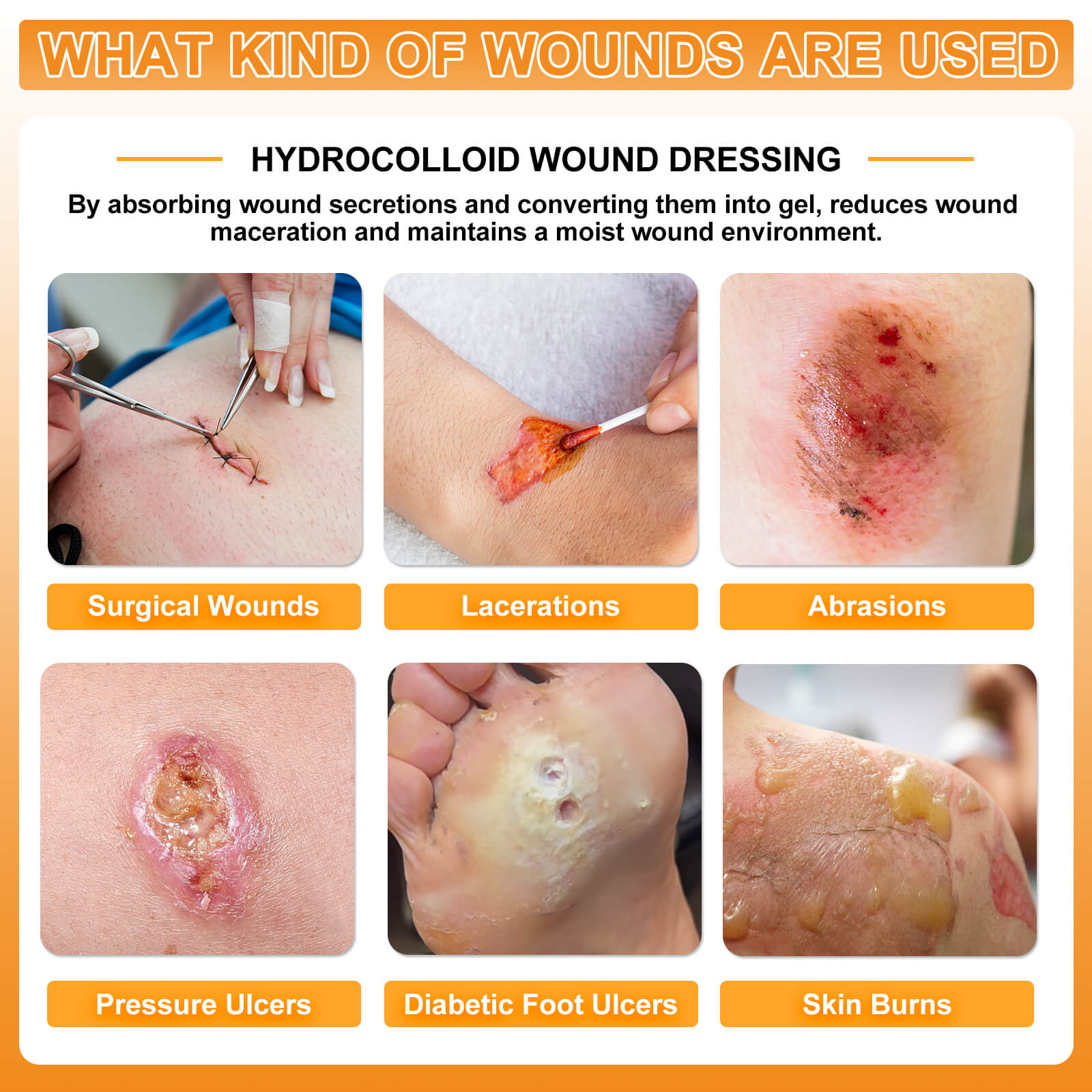Hydrocolloid Dressing – Waterproof Wound Care Patch for Faster Healing Hydrocolloid Dressing – Waterproof Wound Care Patch for Faster Healing