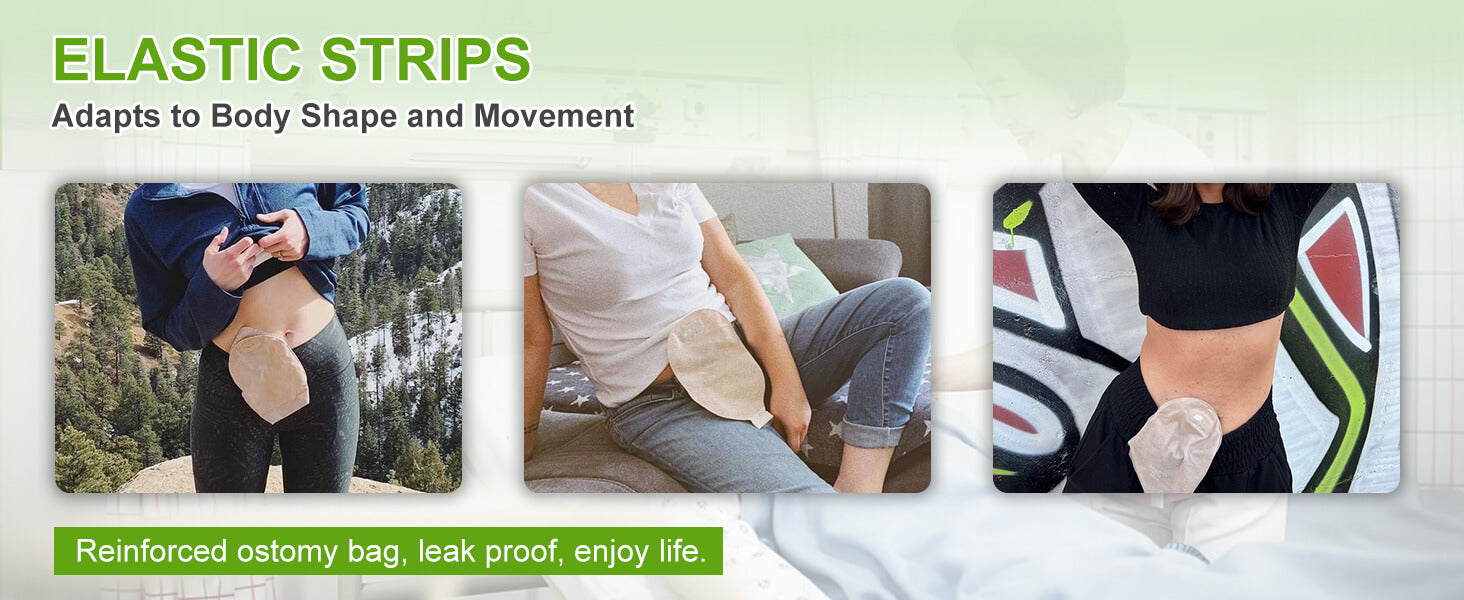 Elastic ostomy barrier strips adapts to body shape and movement