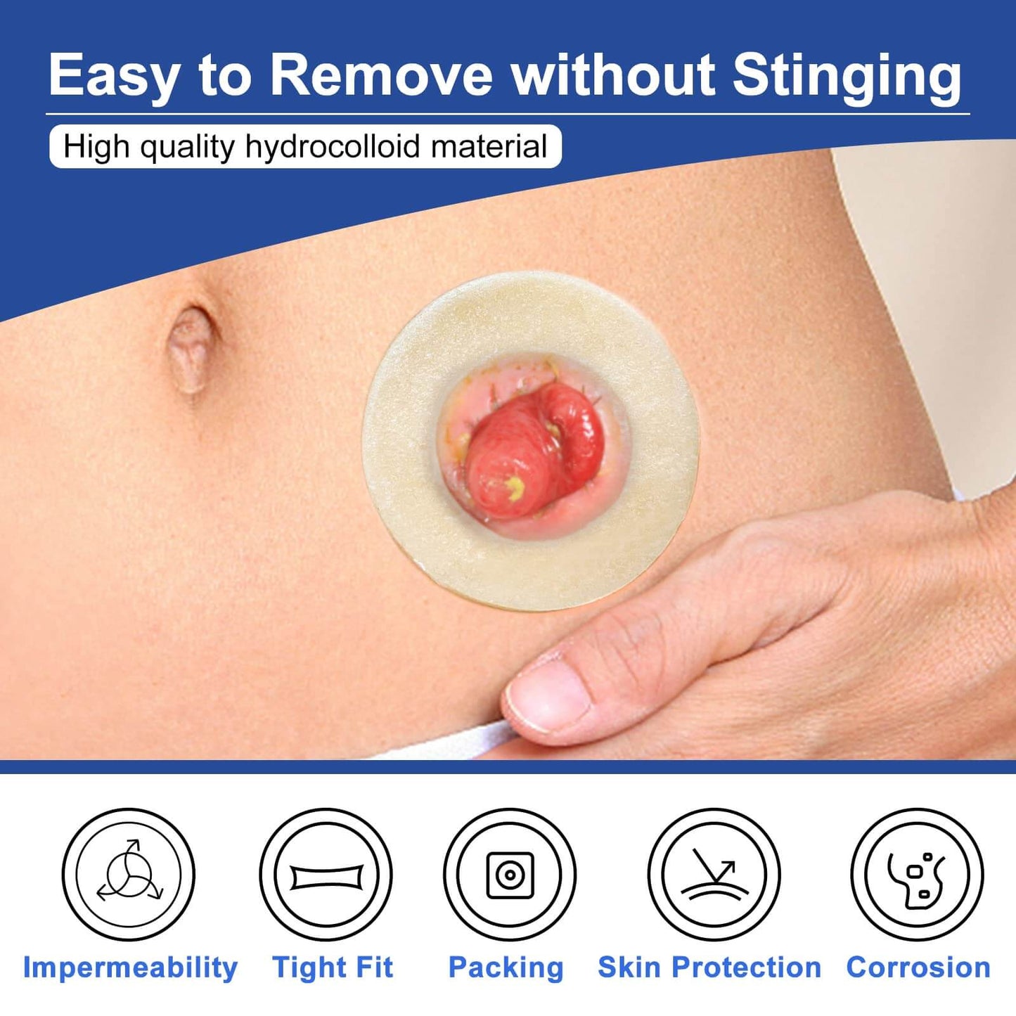 Carbou hydrocolloid barrier ring is easy to remove