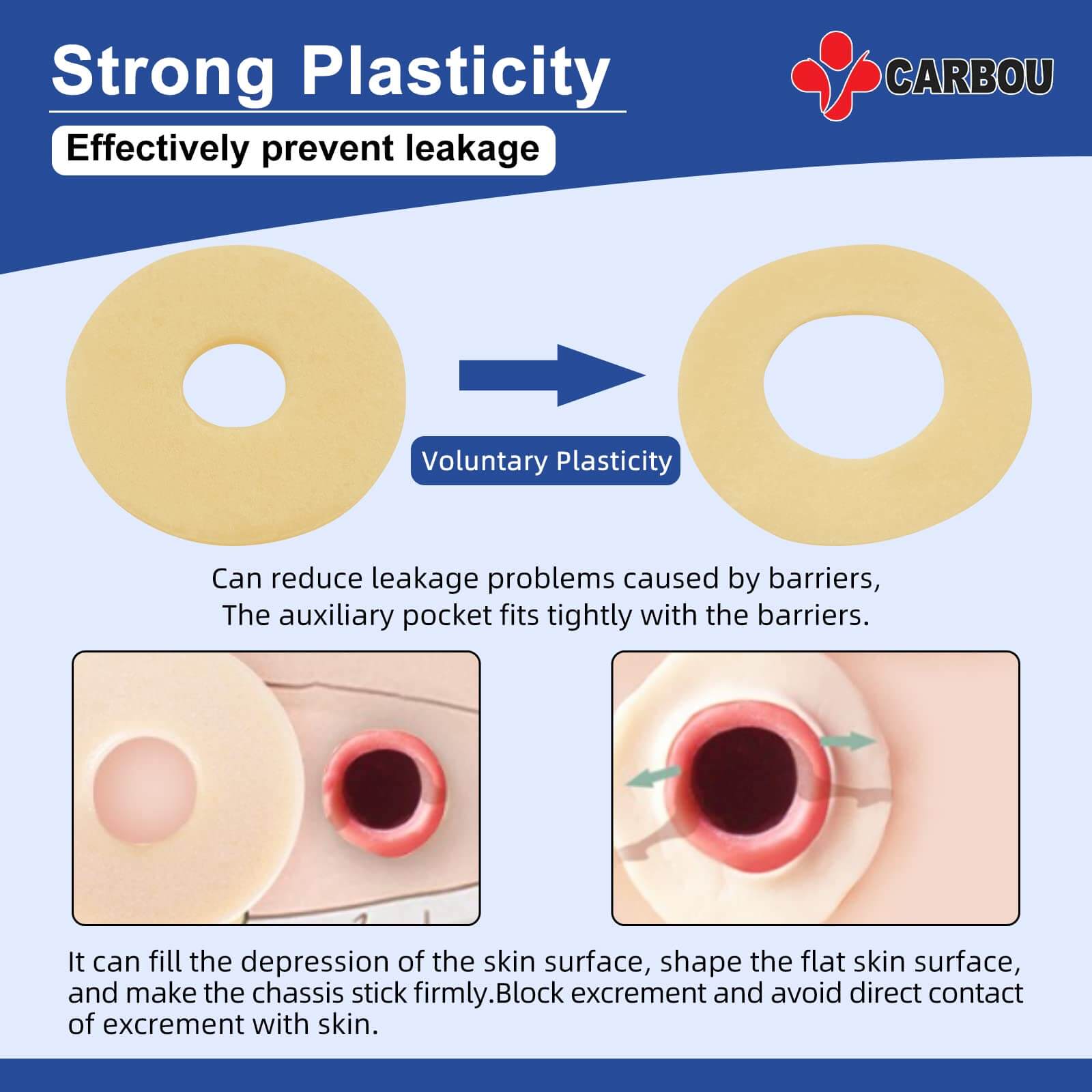 The barrier ring has a strong plasticity.