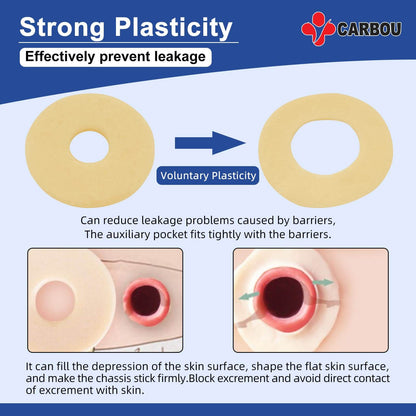 The barrier ring has a strong plasticity.