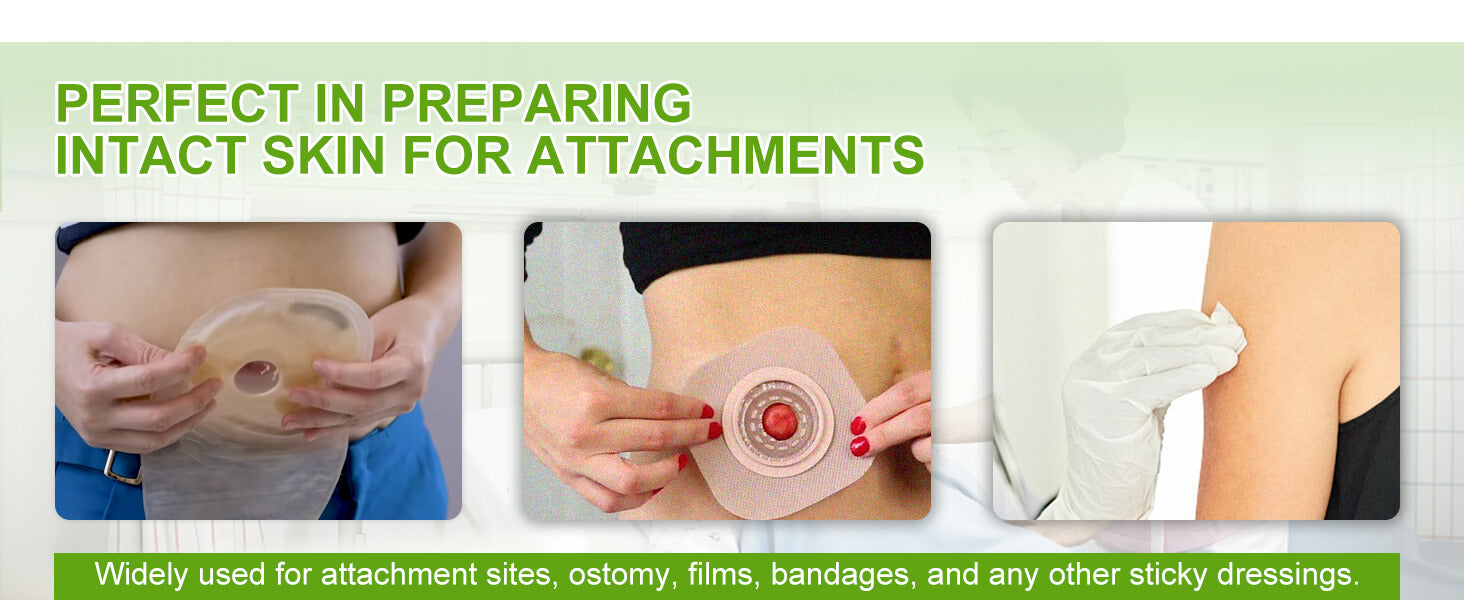 Skin barrier wipes  widely used for attachment sites, ostomy, films, bandages, and any other sticky dressings