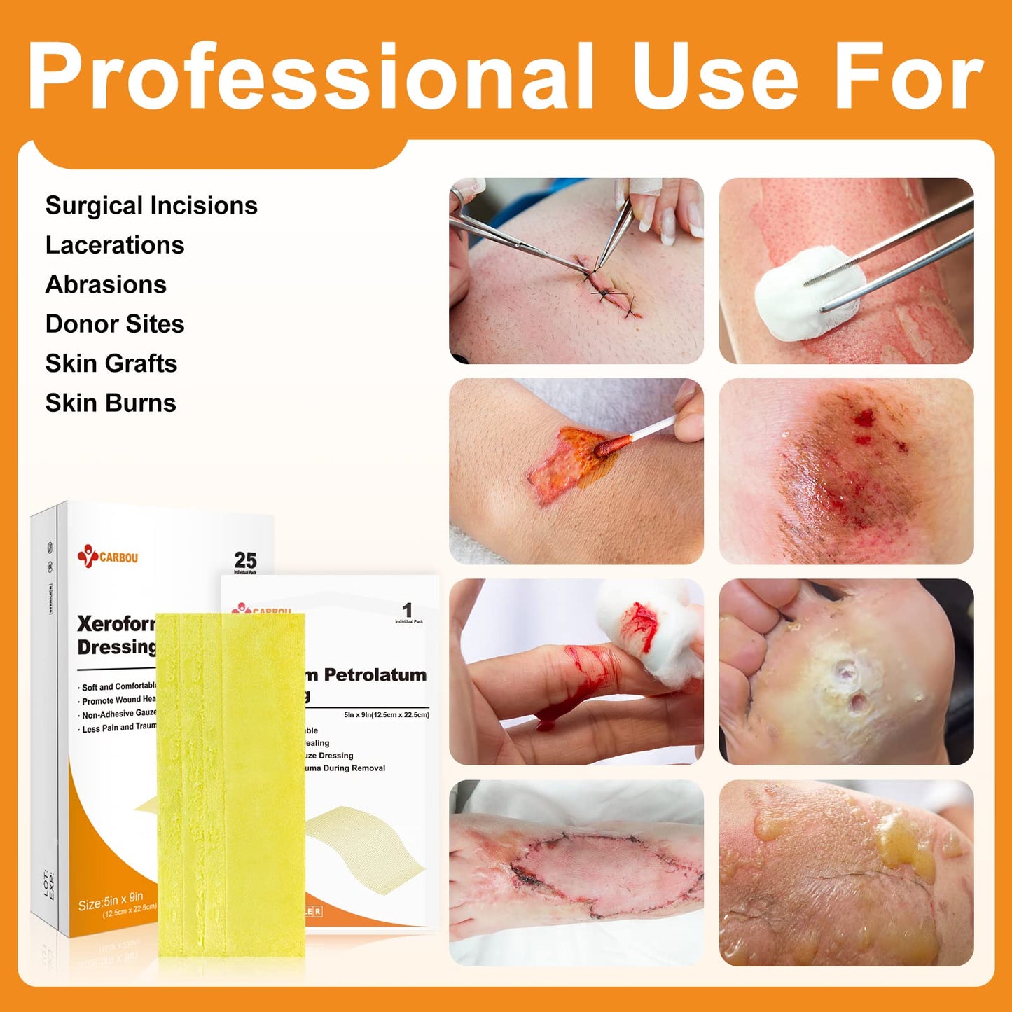Applying xeroform petrolatum dressing