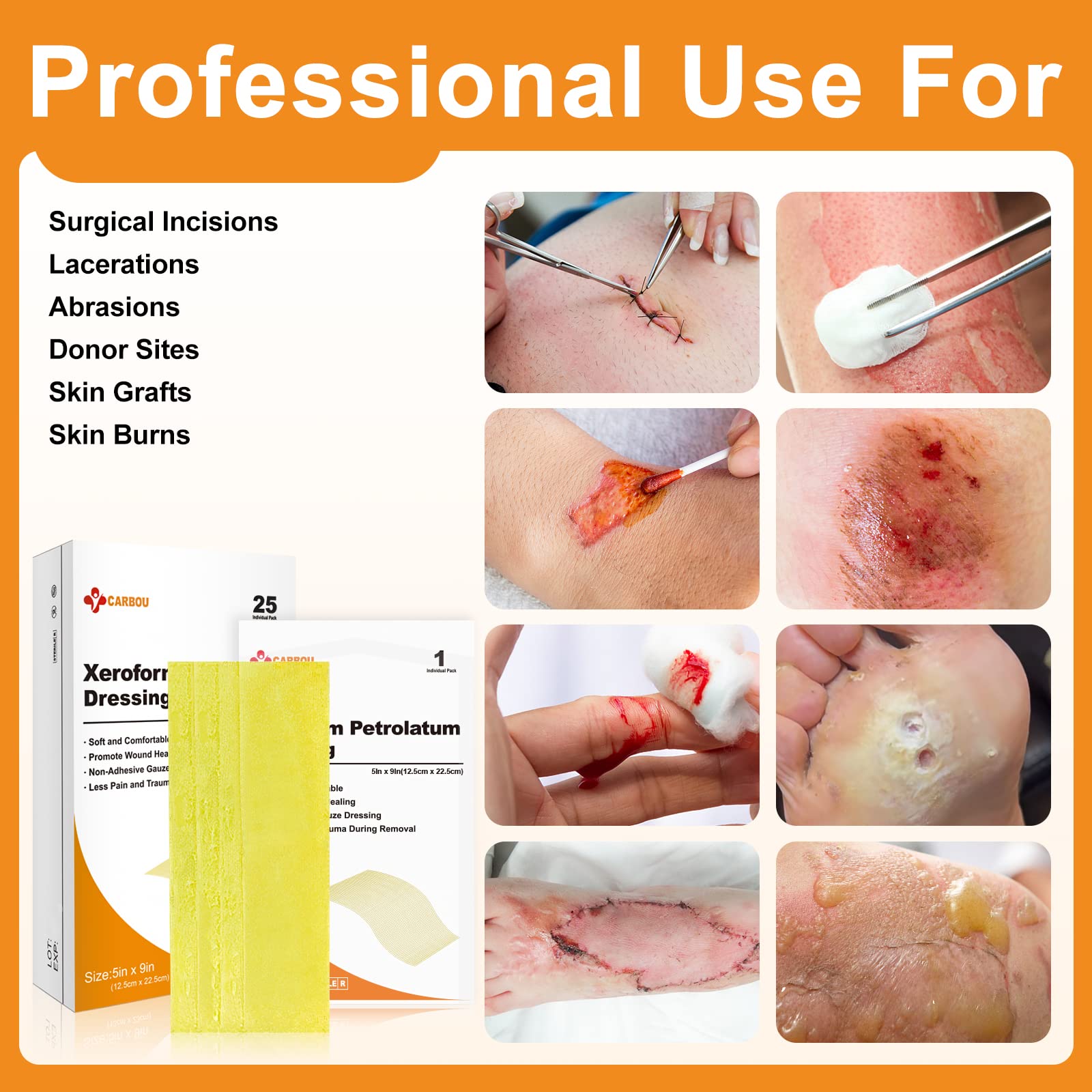 Applying xeroform petrolatum dressing
