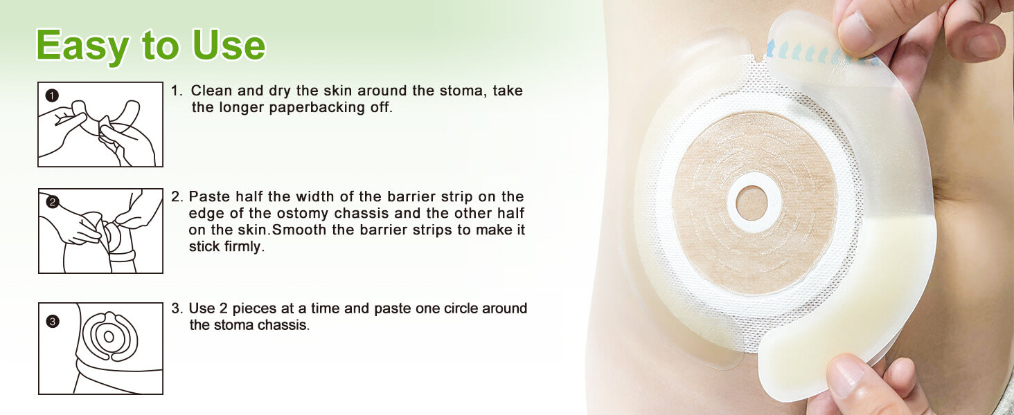 How to use ostomy elastic hydrocolloid barrier strips