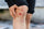 Knee abrasion with redness and drainage risk—when to avoid hydrocolloid dressing on infected wound.