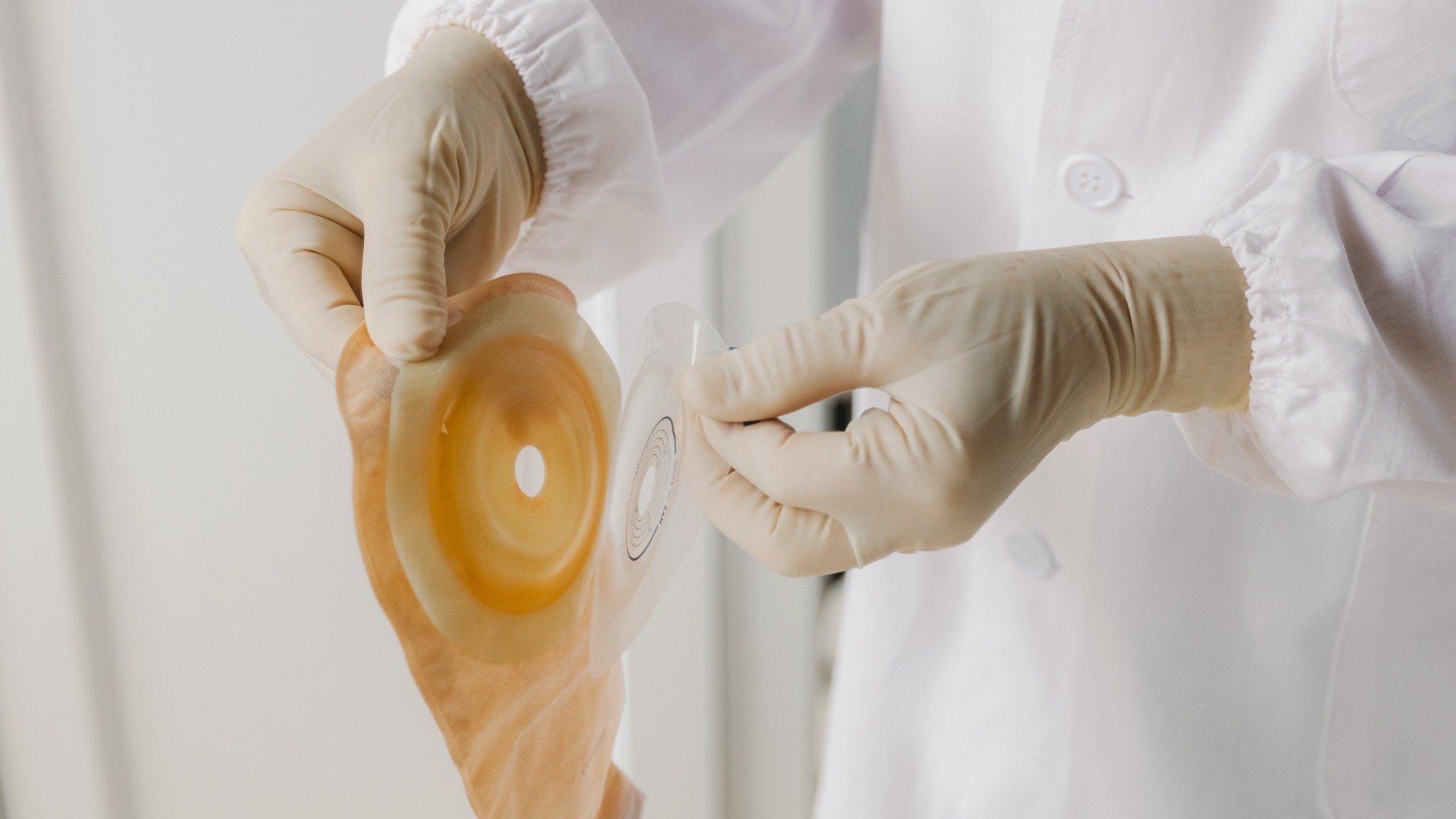 Gloved hands preparing an ostomy pouch and skin barrier for an ileostomy bag change.