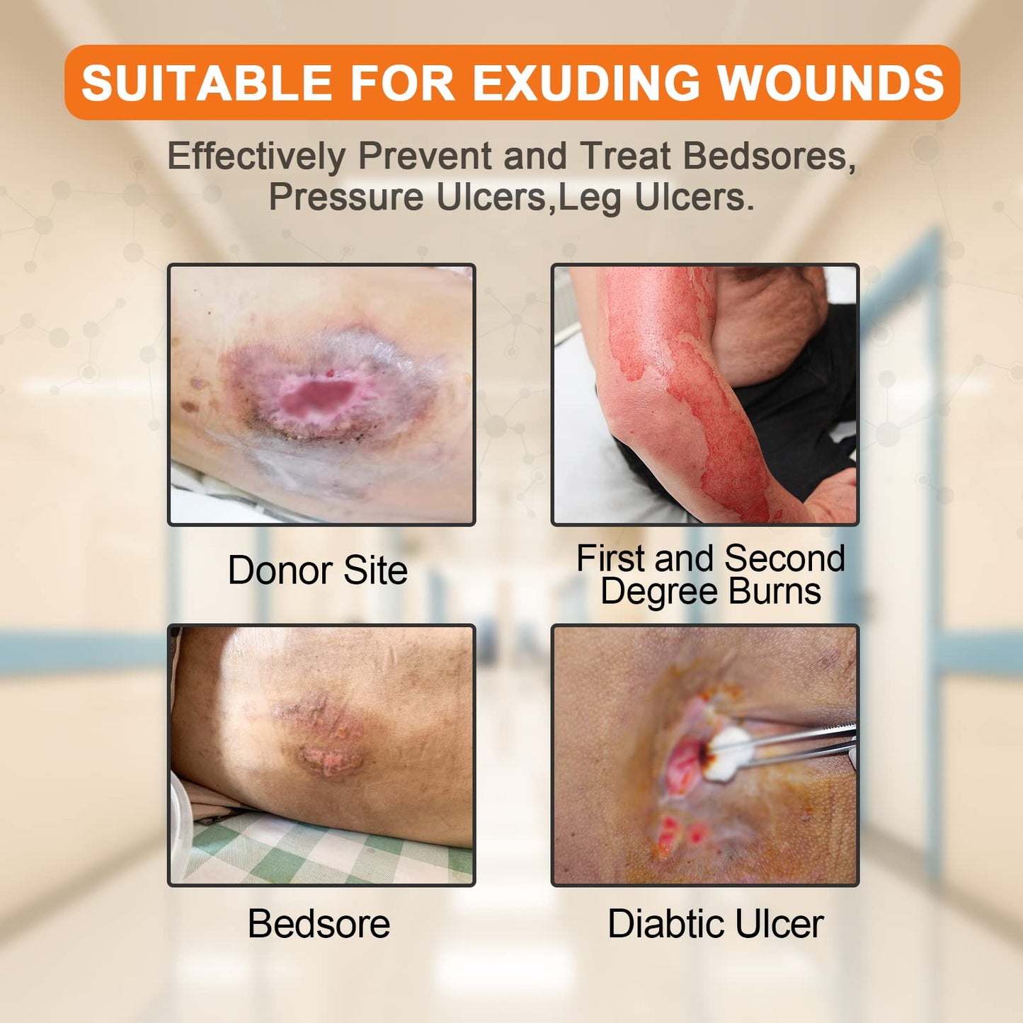 Carbou Silicone Foam Dressing with Adhesive Gentle Border