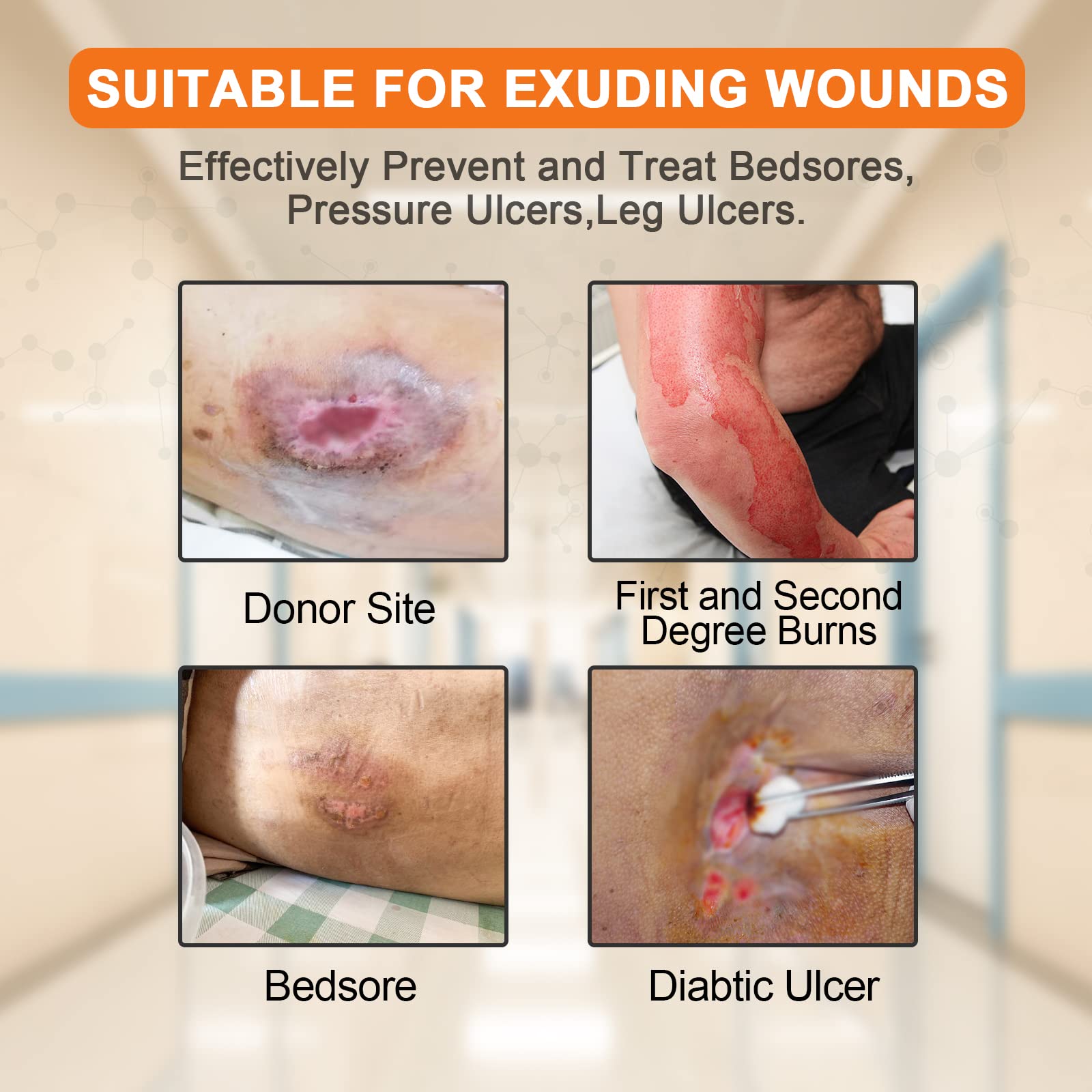 Carbou Silicone Foam Dressing with Adhesive Gentle Border