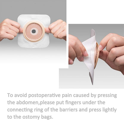 ostomy barrier details display