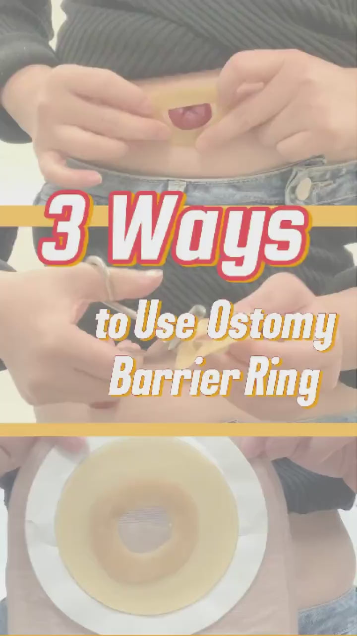 Step-by-Step Guide: 3 Methods for Applying Ostomy Barrier Rings