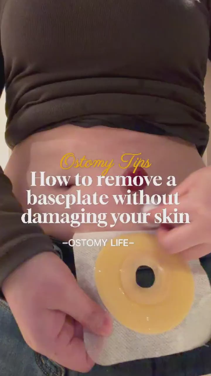 How to Remove an Ostomy Skin Barrier Gently