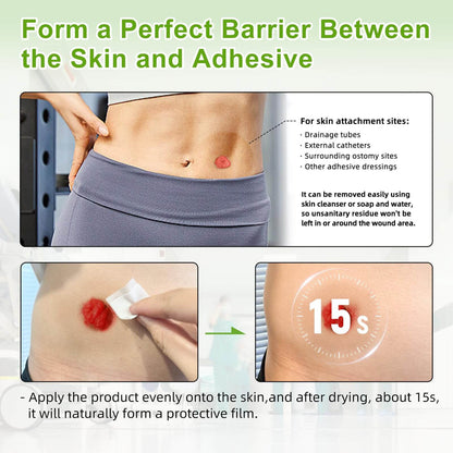 Skin barrier rings is easy to use and remove