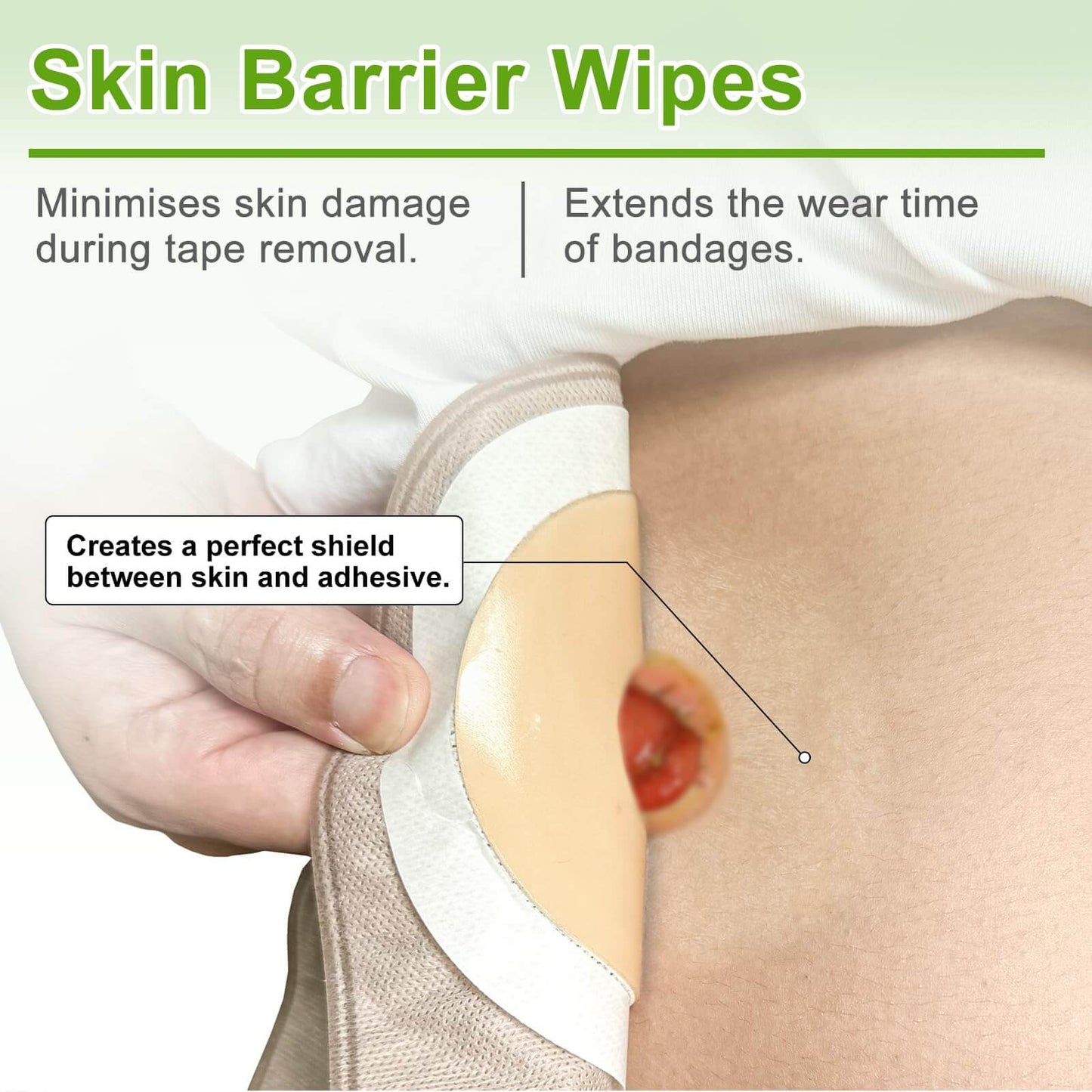 Skin barrier wipes can minimize skin damage during tape removal